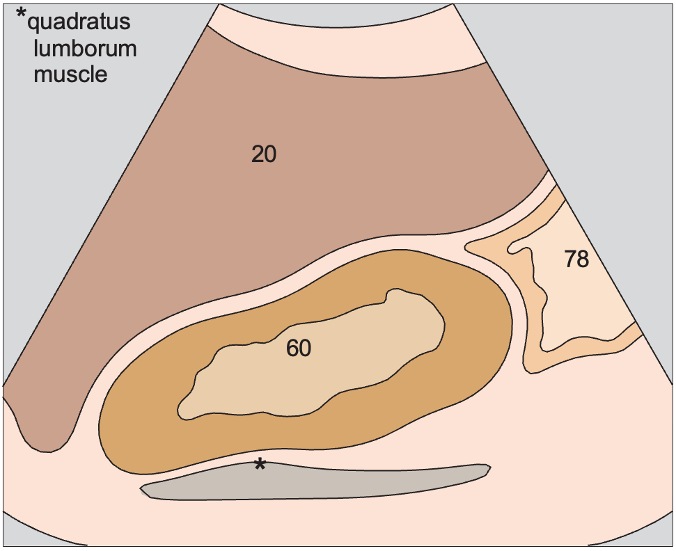 Right kidney anatomy diagram, Kidney, liver, colic flexure