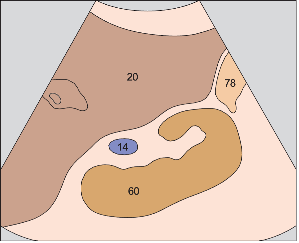 Right kidney anatomy diagram, Kidney, renal vein, colon