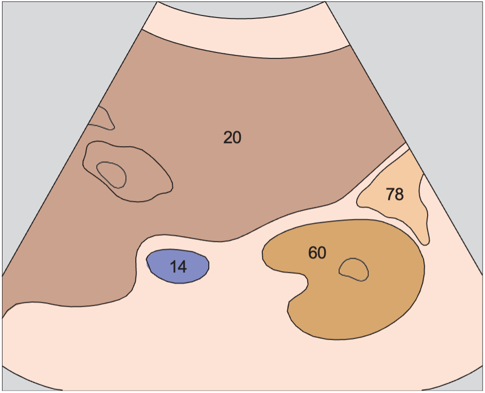 Gallbladder anatomy diagram, Kidney, renal vein, colon