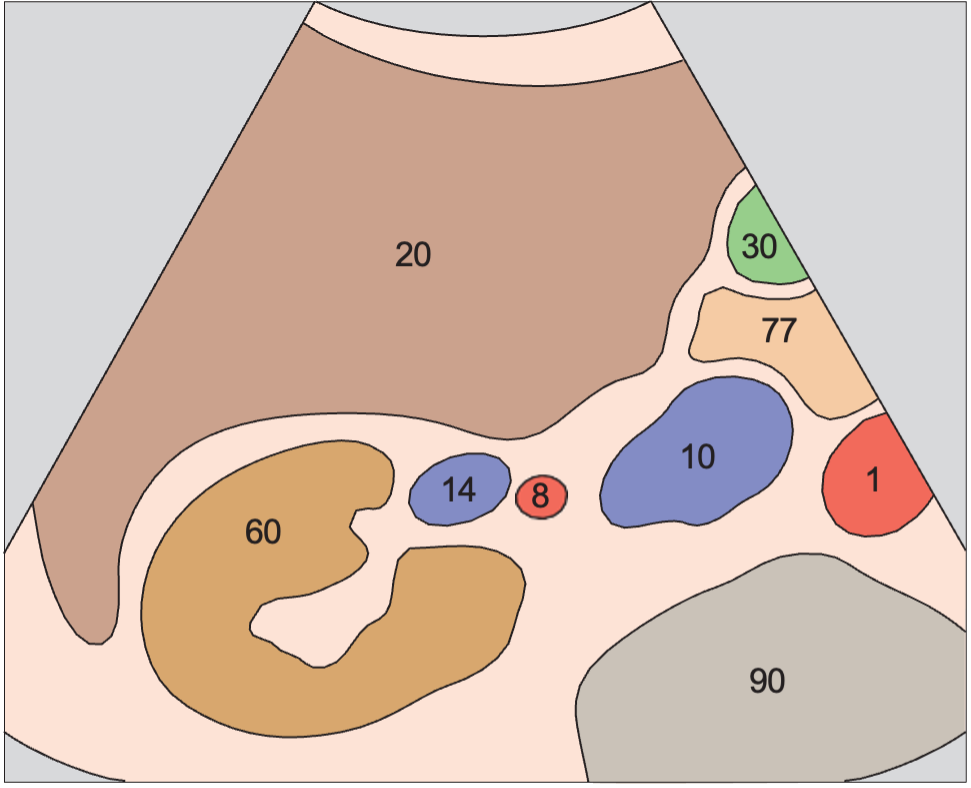 Right kidney anatomy diagram, Kidney, renal vein, renal artery, vena cava, liver