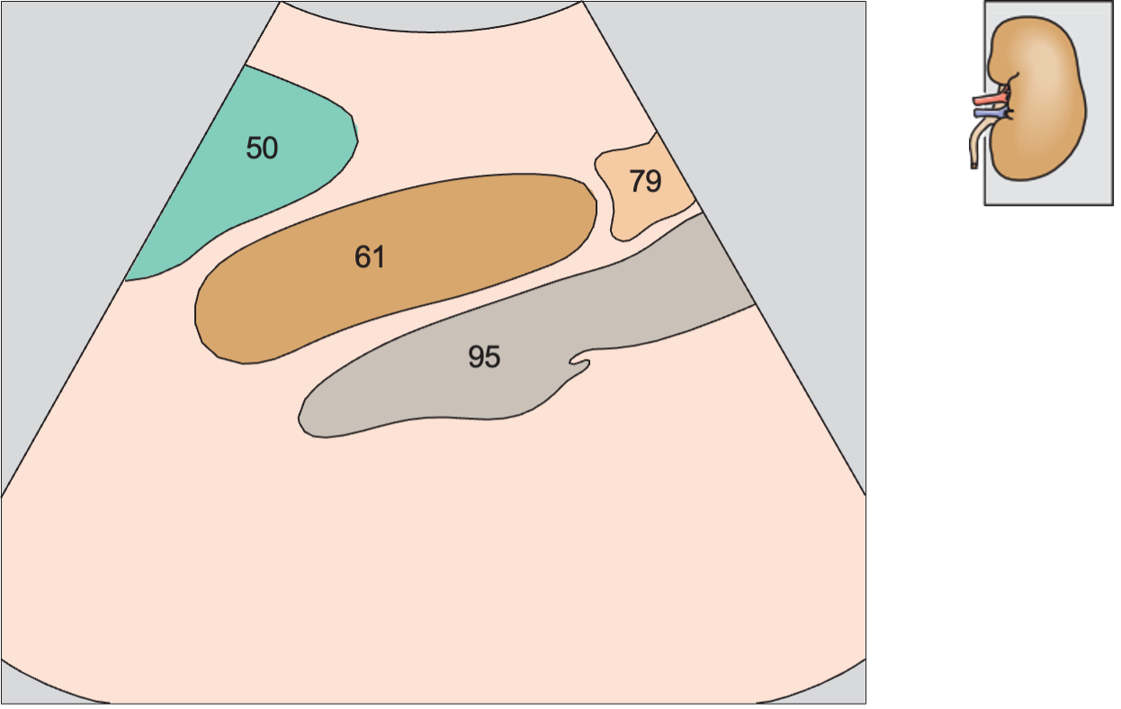 Spleen anatomy diagram, Kidney, spleen, psoas muscle