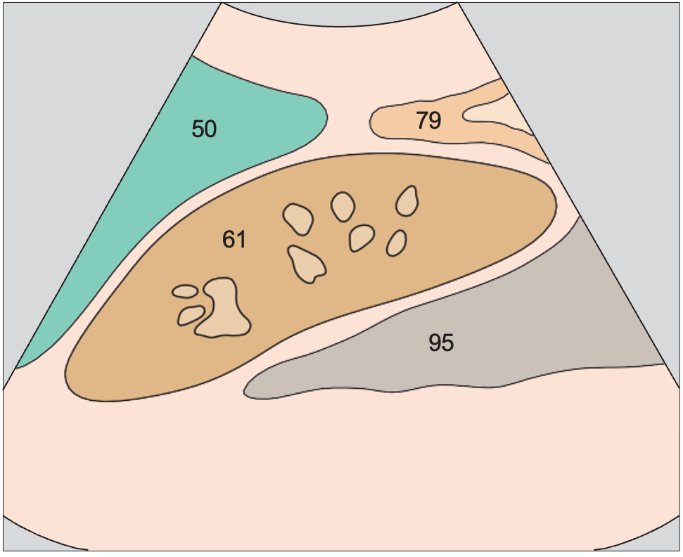 Spleen anatomy diagram, Kidney, spleen, psoas muscle