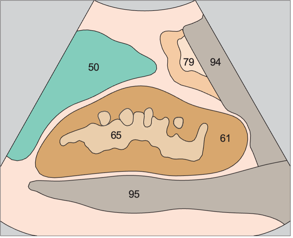 Spleen anatomy diagram, Kidney, spleen, psoas muscle