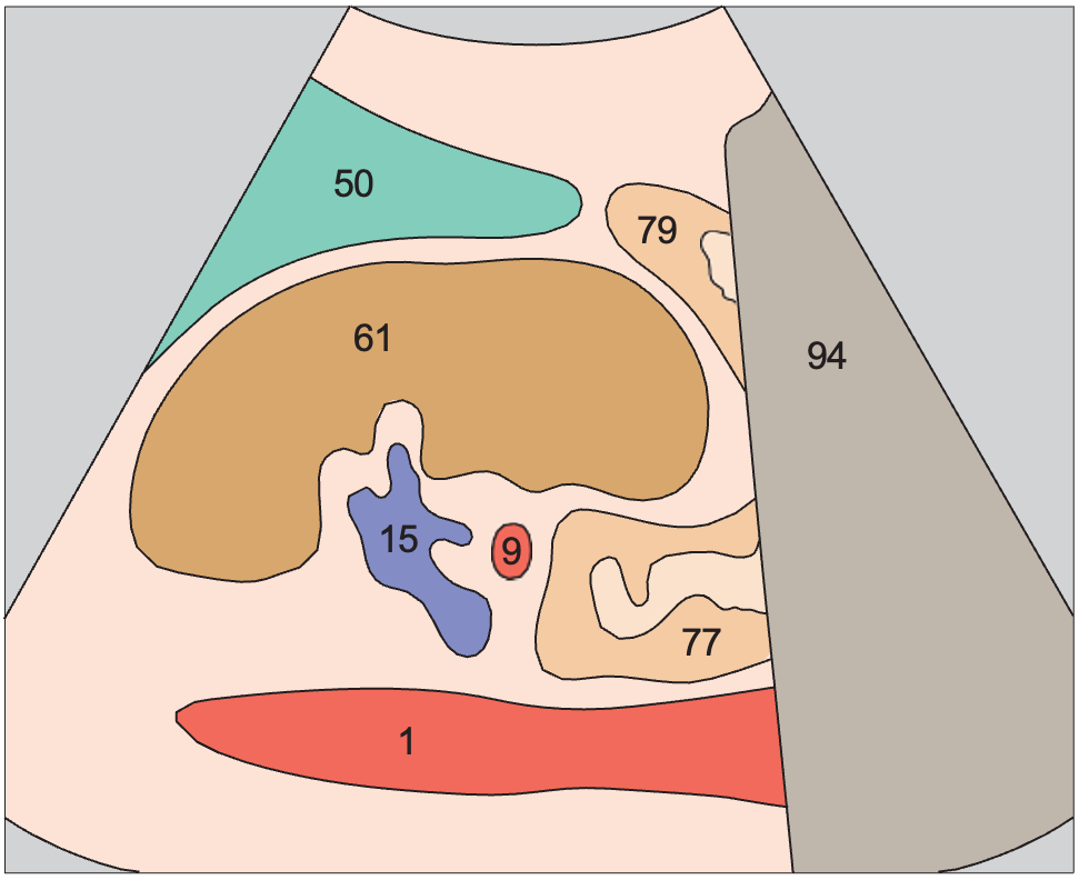 Spleen anatomy diagram, Kidney, renal vein, spleen, aorta