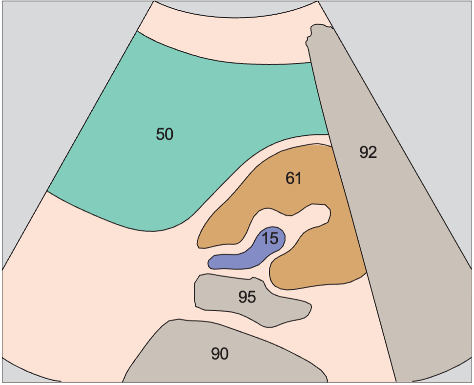 Spleen anatomy diagram, Kidney, spleen, psoas muscle