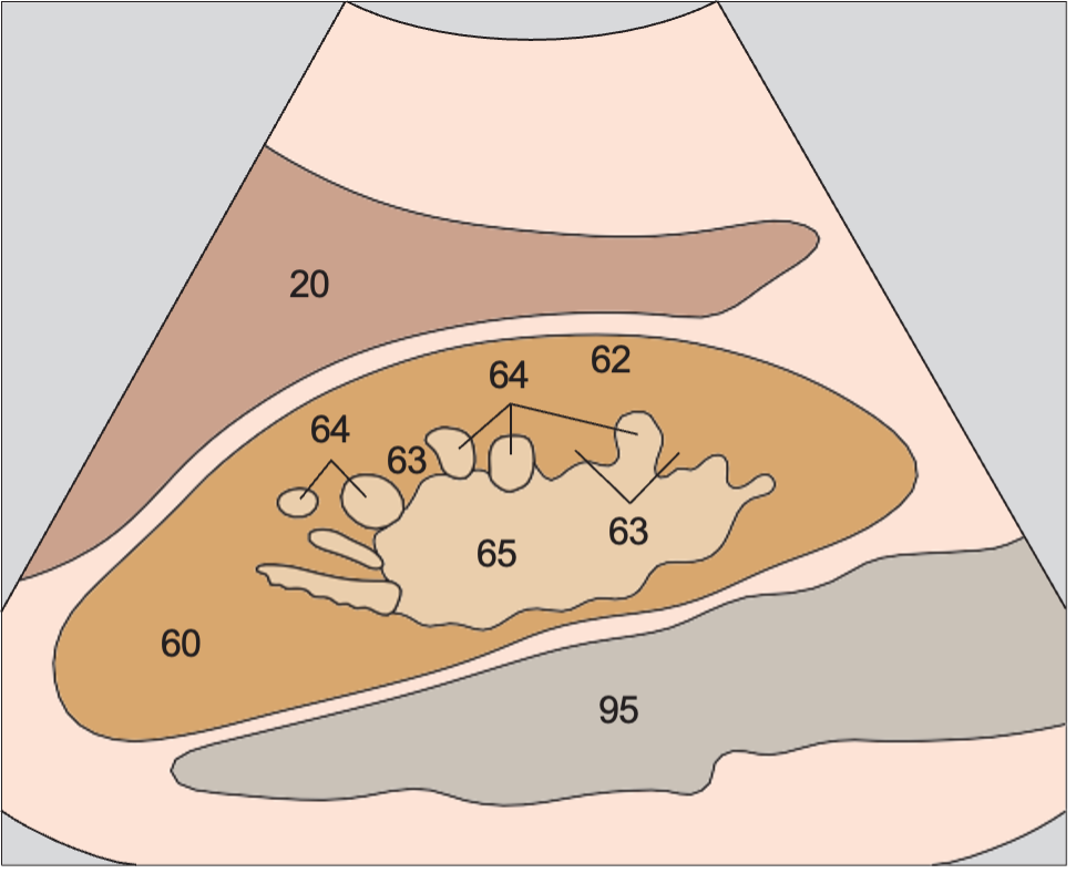 Renal cortex anatomy diagram, Medullary pyramids