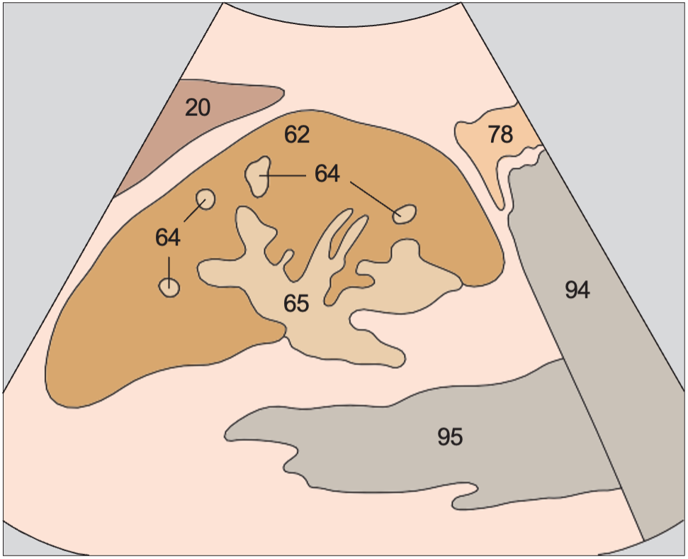 Renal cortex anatomy diagram, Collecting system