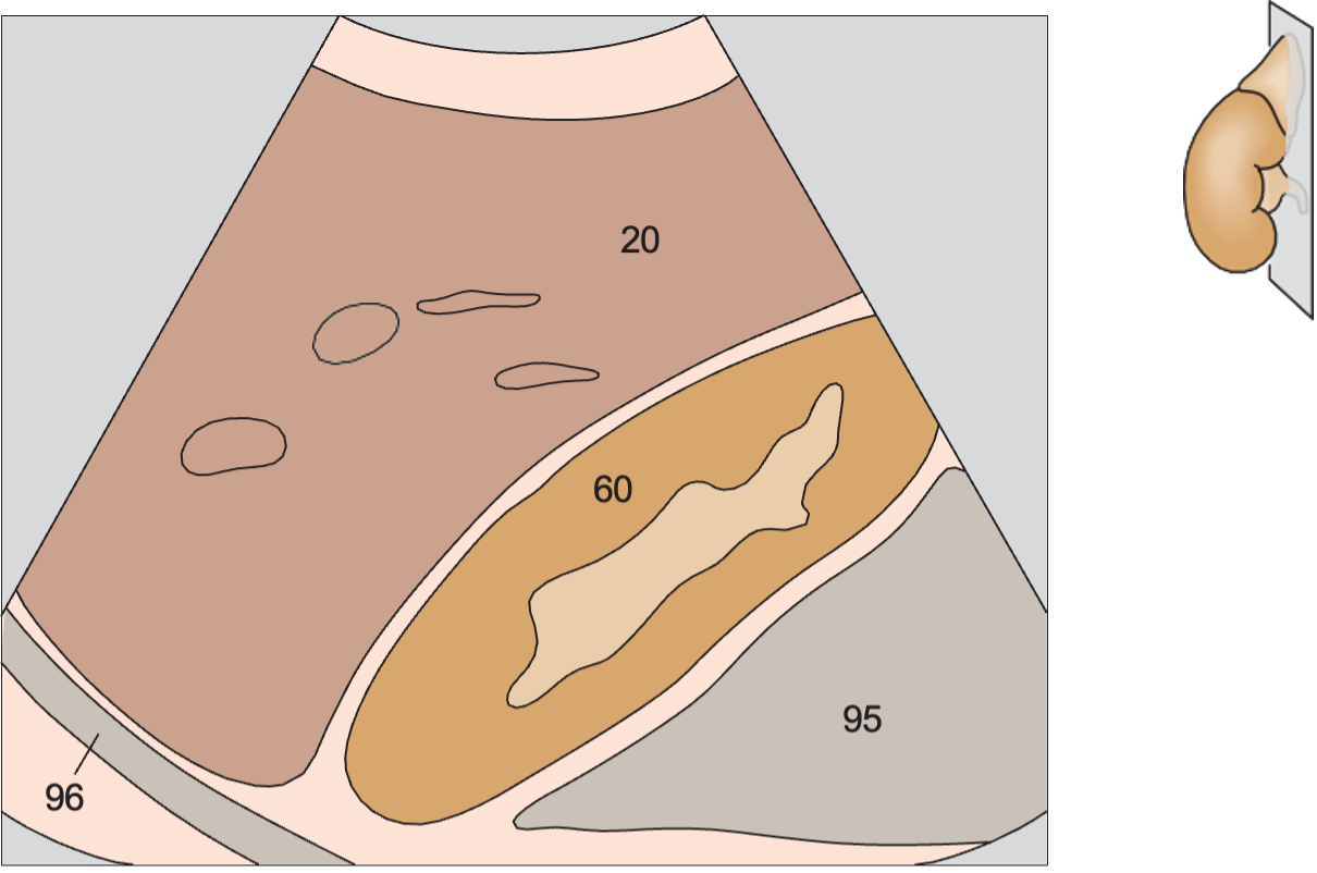 Right kidney anatomy diagram, Kidney, liver