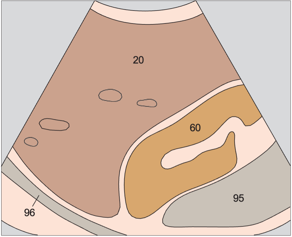 Right kidney anatomy diagram, Kidney, liver