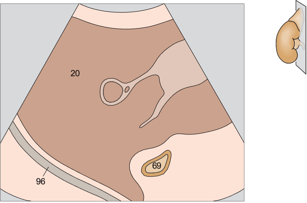 Right lobe of liver anatomy diagram, Adrenal gland, liver