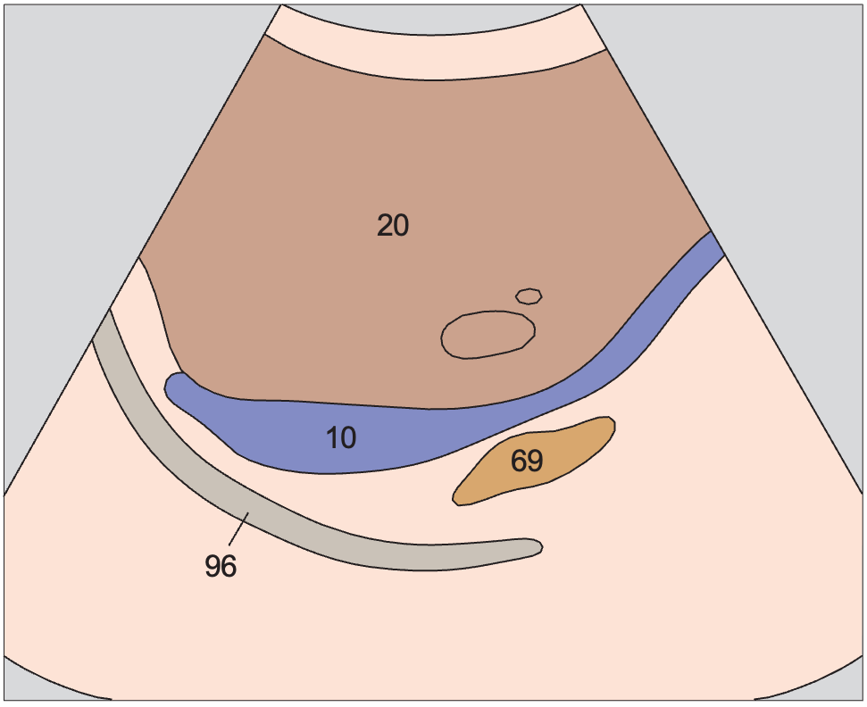 Right renal artery anatomy diagram, Adrenal gland, vena cava, renal artery