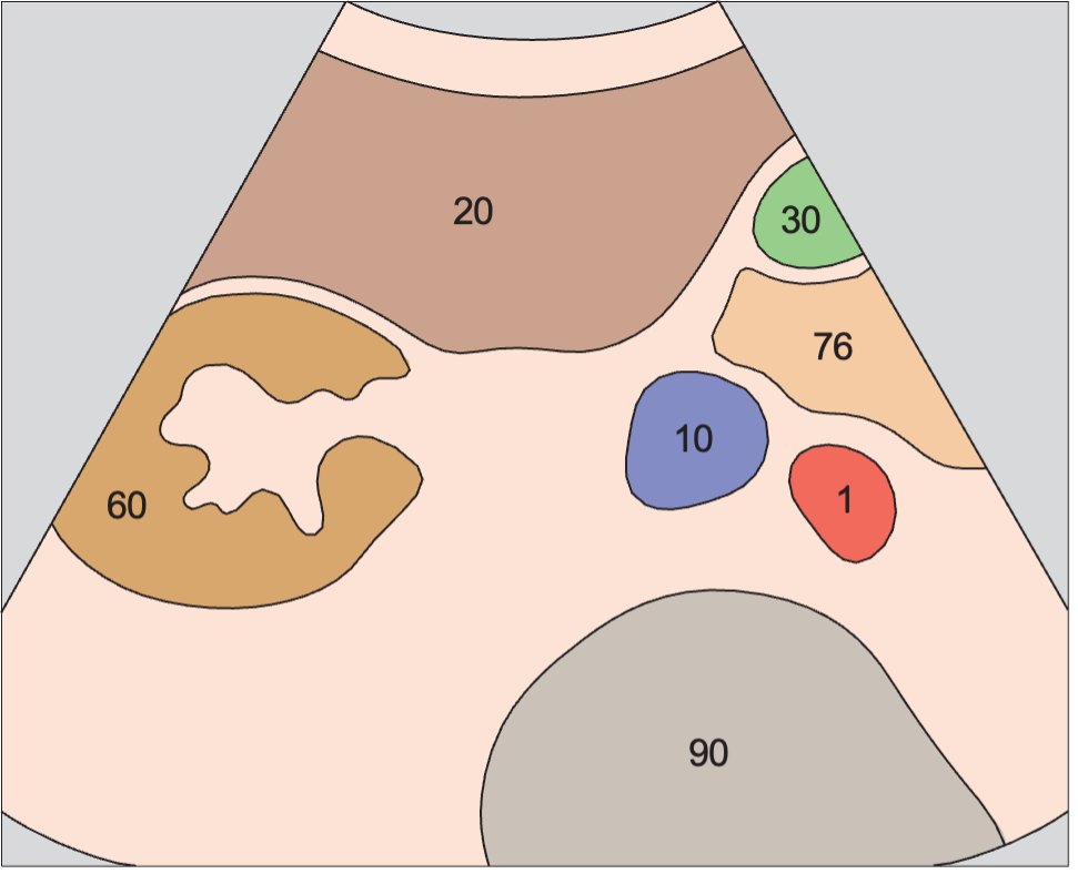 Duodenum anatomy diagram, Kidney, vena cava