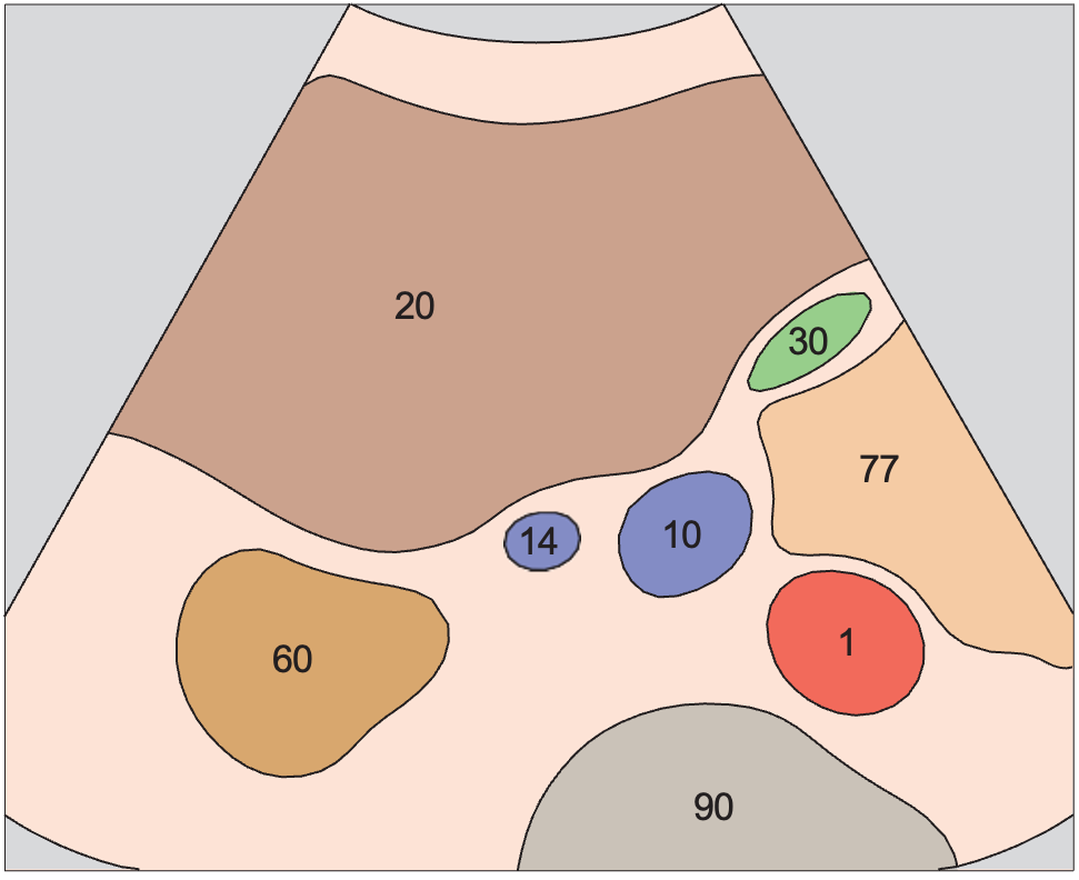 Gallbladder anatomy diagram, Kidney, renal vein, vena cava