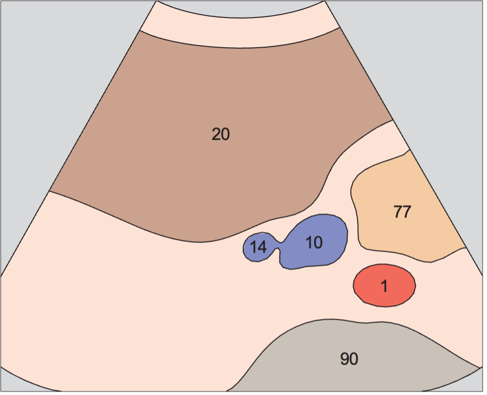 Spinal column anatomy diagram, Renal vein, vena cava