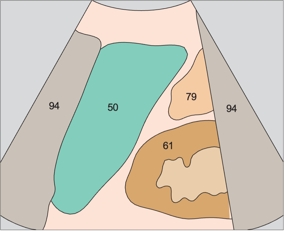 Spleen anatomy diagram, Kidney, spleen
