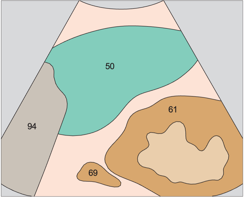 Spleen anatomy diagram, Adrenal gland, kidney, spleen