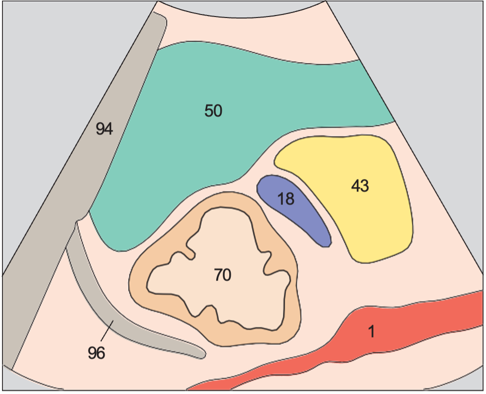 Spleen anatomy diagram, Spleen, tail of pancreas