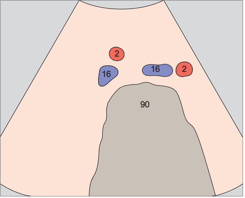 Spinal column anatomy diagram, Iliac vessels