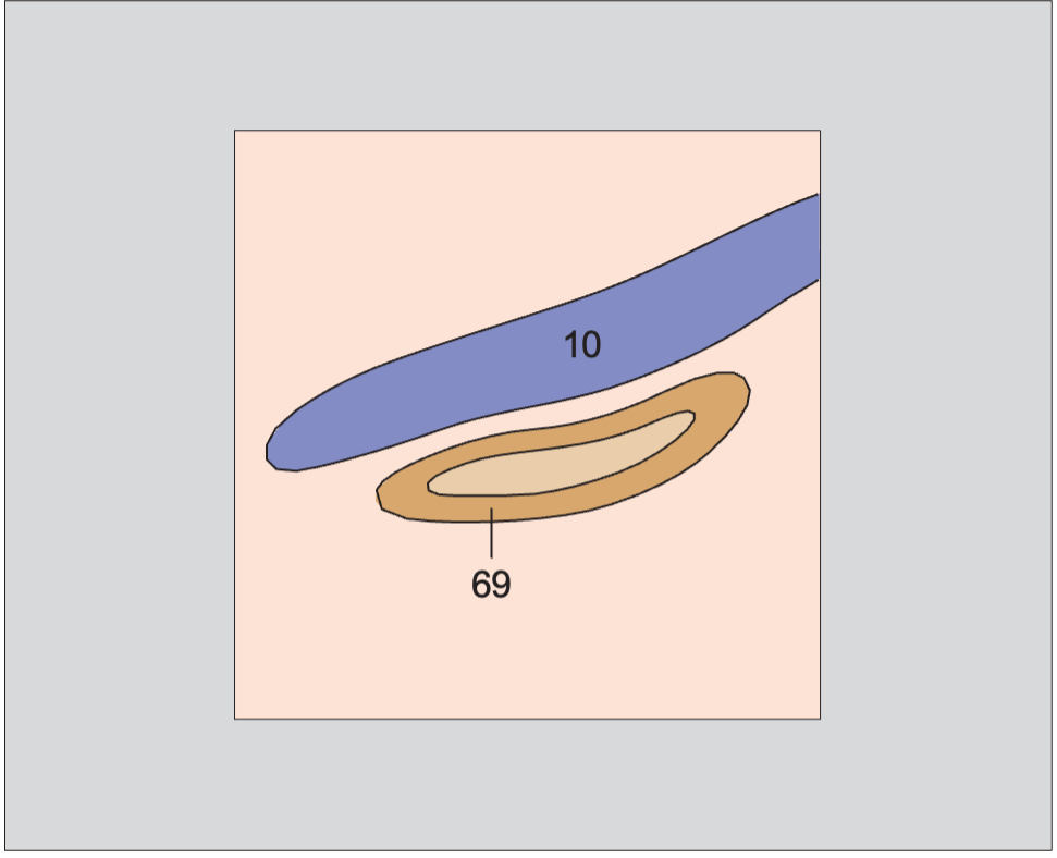 Vena cava anatomy diagram, Layers of adrenal gland