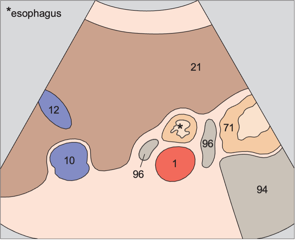 Middle hepatic vein anatomy diagram, Esophagus, aorta, liver