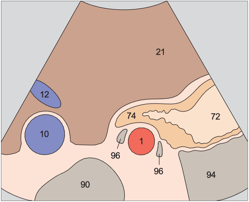 Middle hepatic vein anatomy diagram, Cardia, aorta, liver