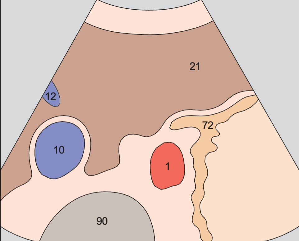 Middle hepatic vein anatomy diagram, Cardia, body of stomach, aorta, liver