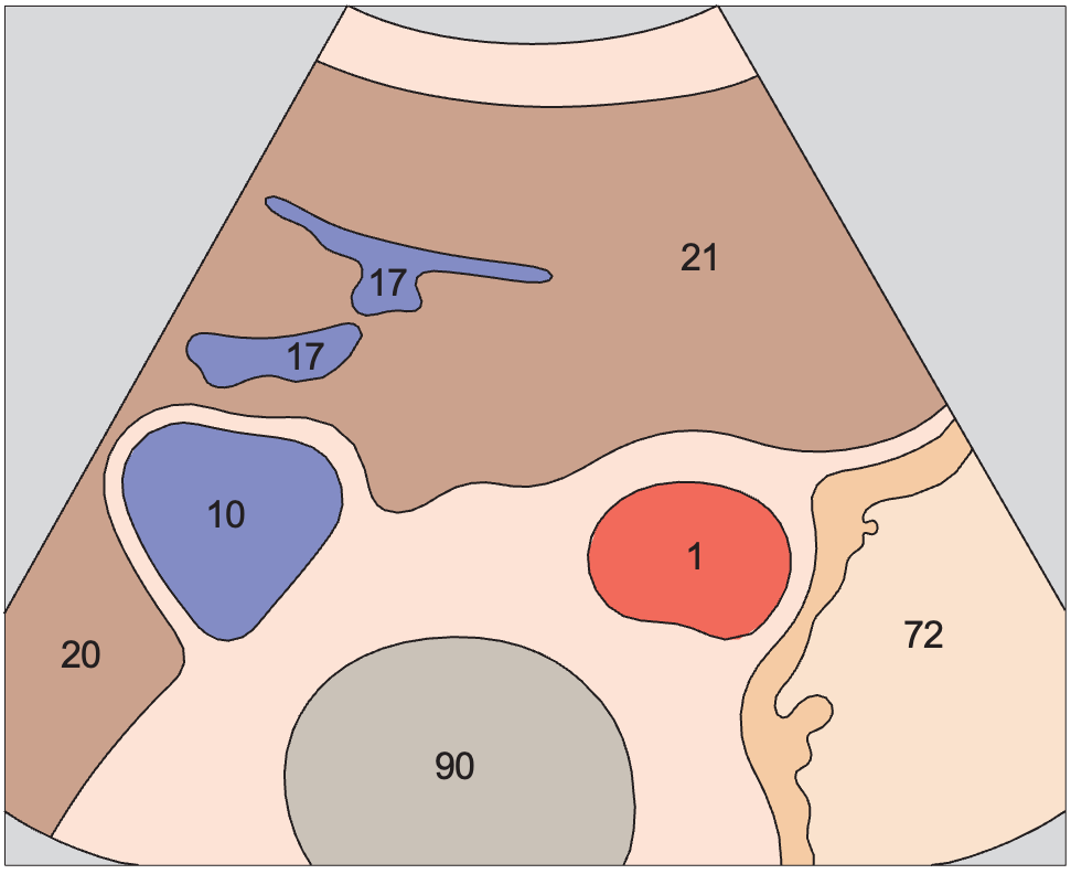Quadrate lobe anatomy diagram, Body of stomach, aorta, liver