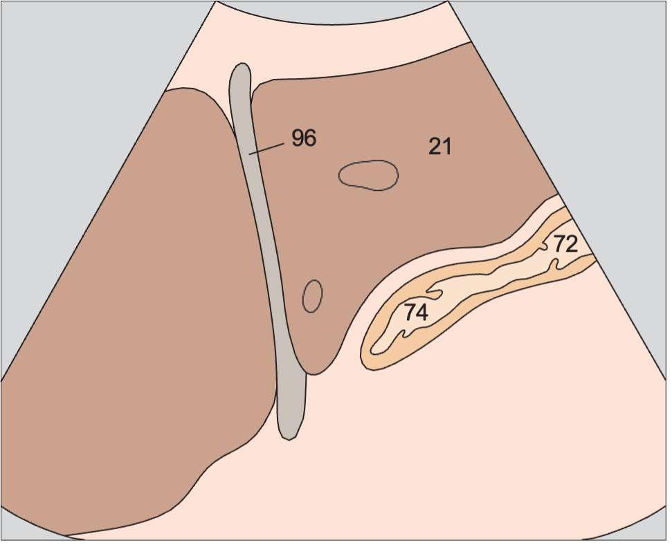 Body of stomach anatomy diagram, Cardia, liver