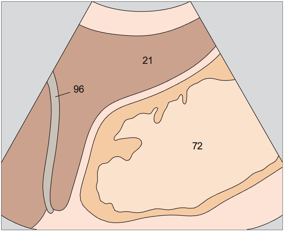 Body of stomach anatomy diagram, Body of stomach, liver