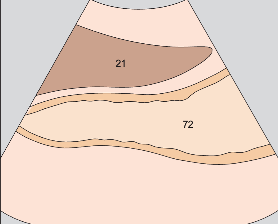 Pancreatic duct anatomy diagram, Body of stomach, liver