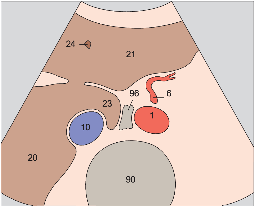 Caudate lobe anatomy diagram, Left gastric artery