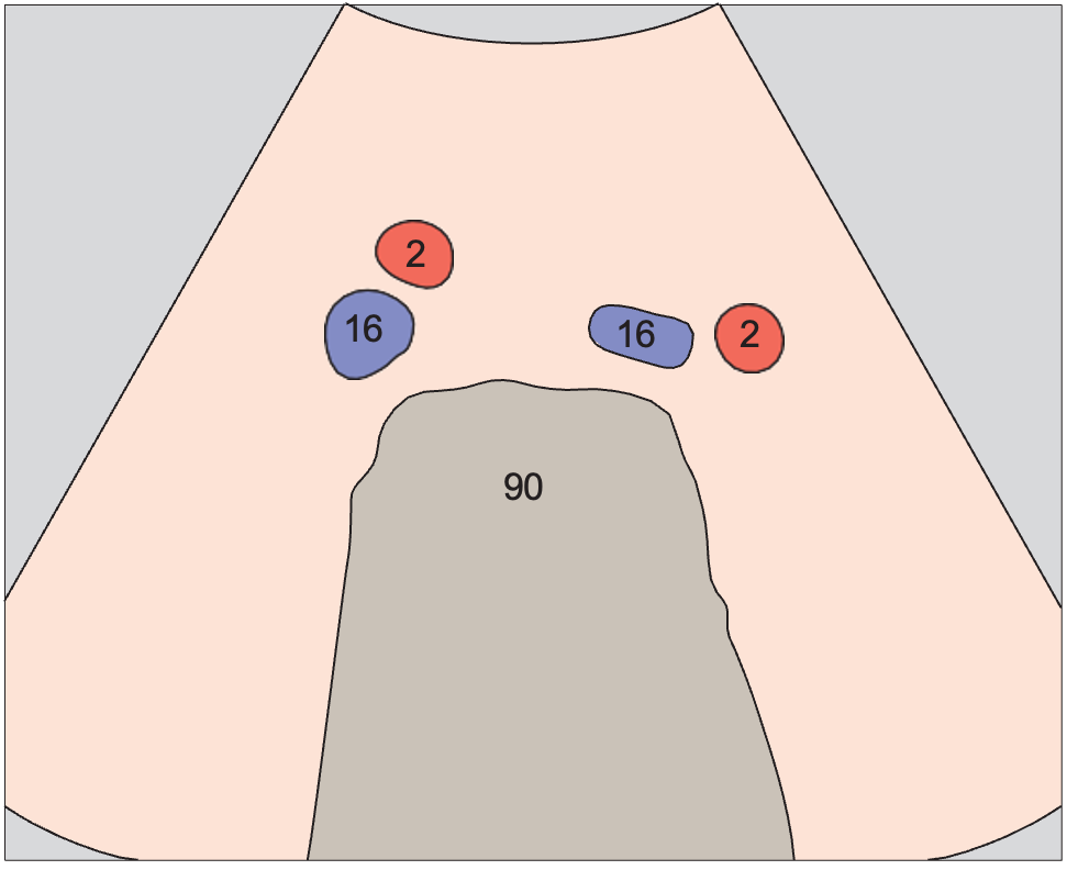 Spinal column anatomy diagram, Iliac vessels