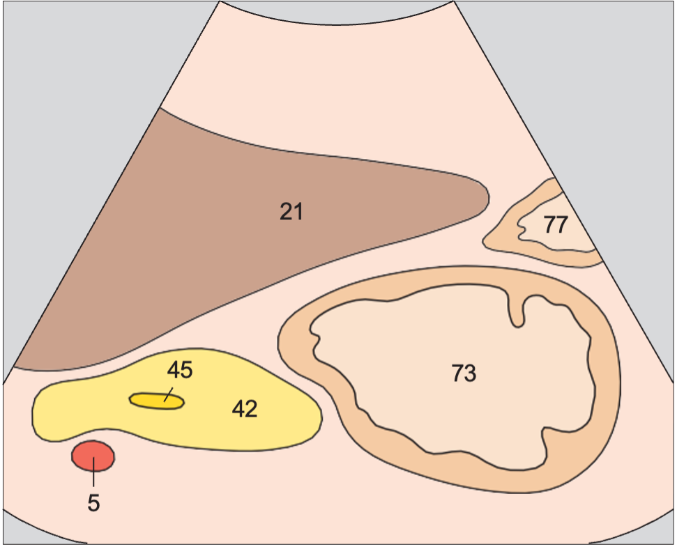 Body of stomach anatomy diagram, Antrum, liver, pancreas