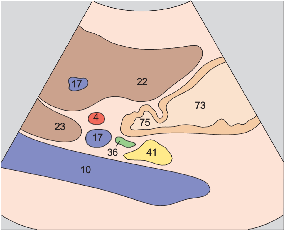 Caudate lobe anatomy diagram, Pylorus, pancreas, liver