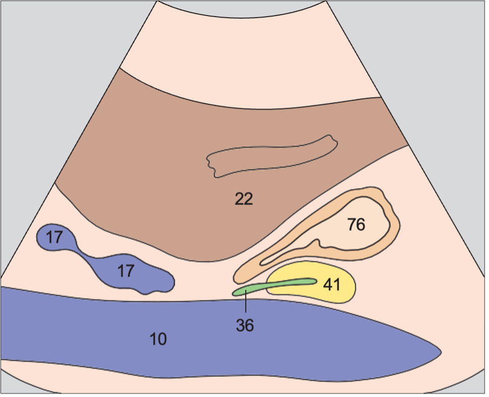 Duodenum anatomy diagram, Duodenal bulb, liver, vena cava