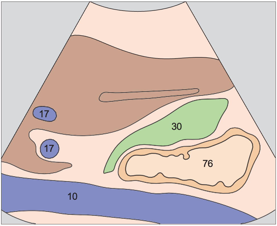 Duodenum anatomy diagram, Duodenum, gallbladder, vena cava