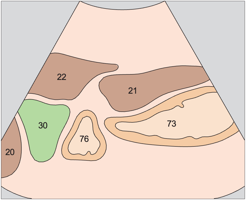 Duodenum anatomy diagram, Antrum, gallbladder