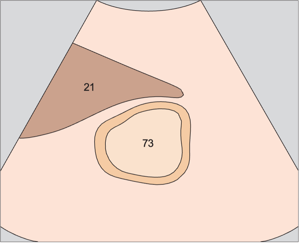 Antrum of stomach anatomy diagram, Layers of gastric wall