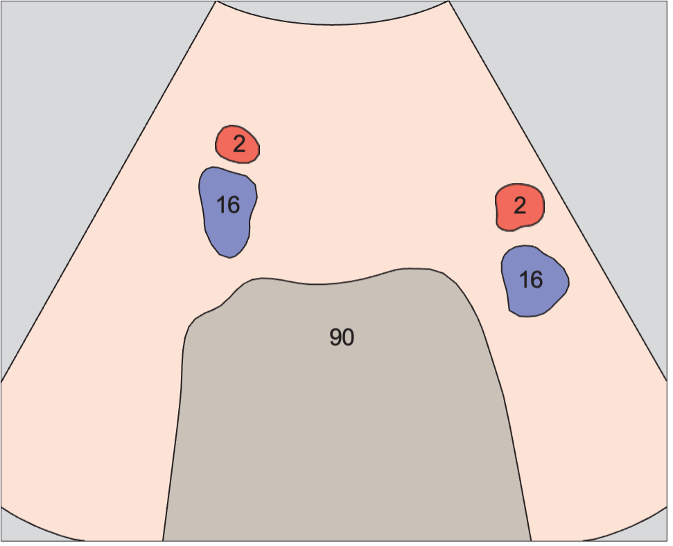 Spinal column anatomy diagram, Iliac vessels