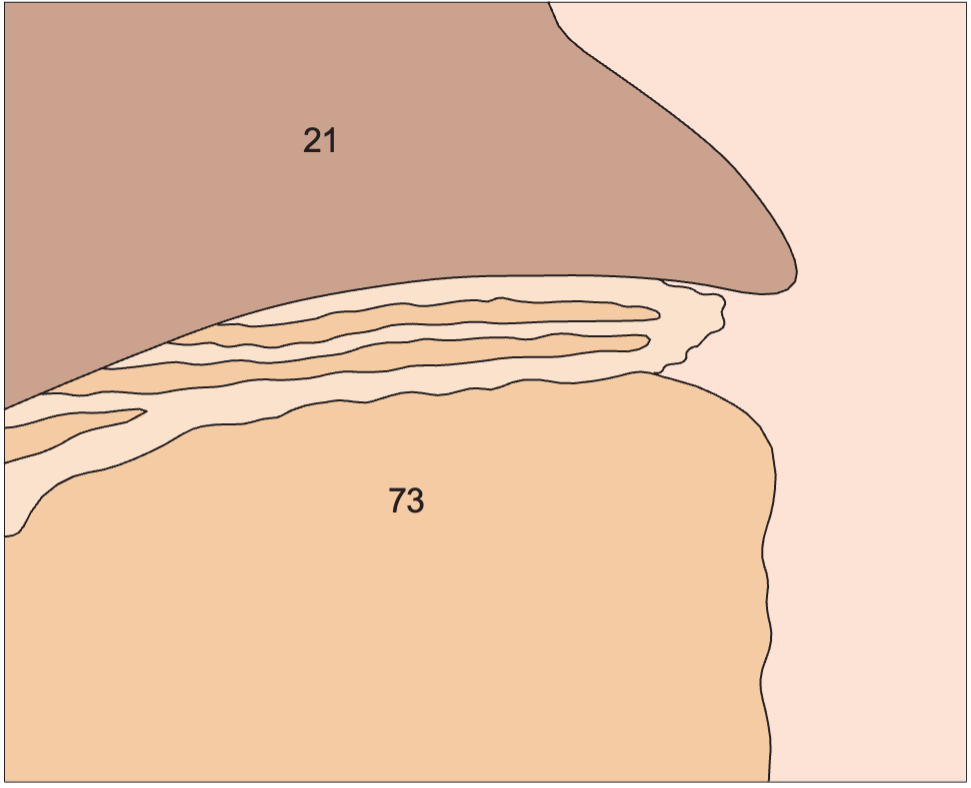 Antrum of stomach anatomy diagram, Layers of gastric wall