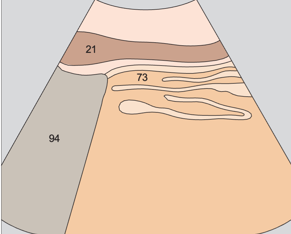 Artifact anatomy diagram, Gastric folds