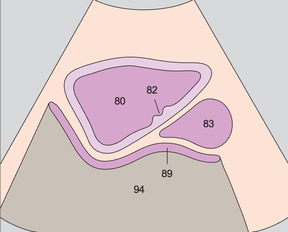 Bladder anatomy diagram, Bladder, prostate, rectum