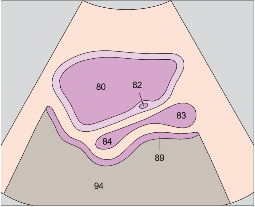 Bladder anatomy diagram, Bladder, ureteral orifice, prostate, rectum