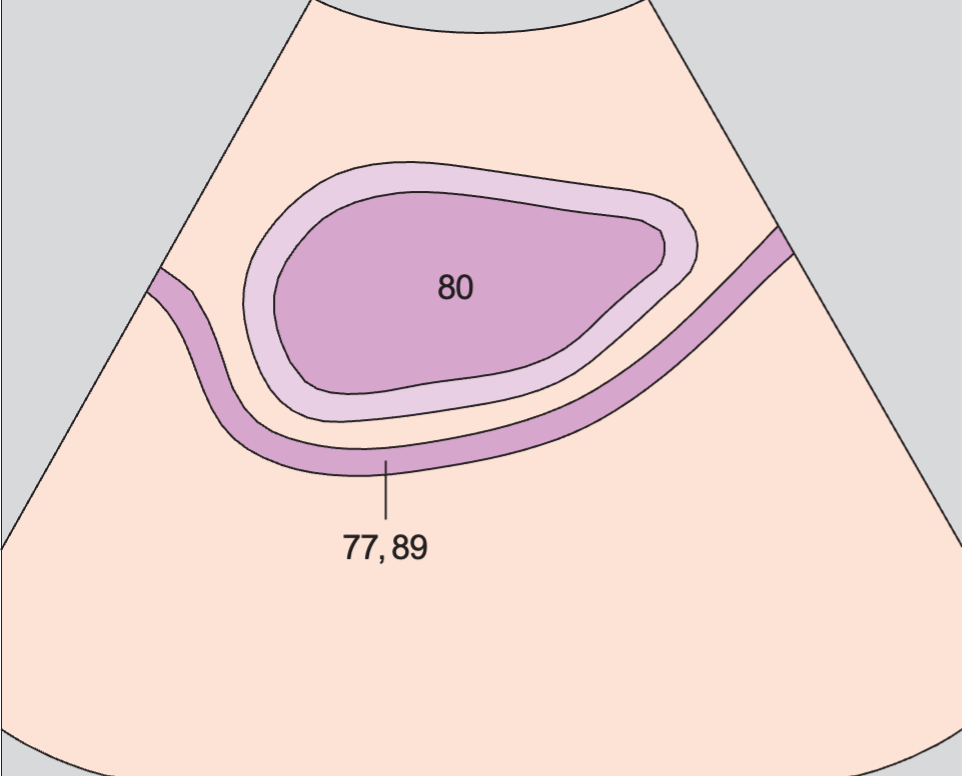 Bladder anatomy diagram, Bladder, rectum