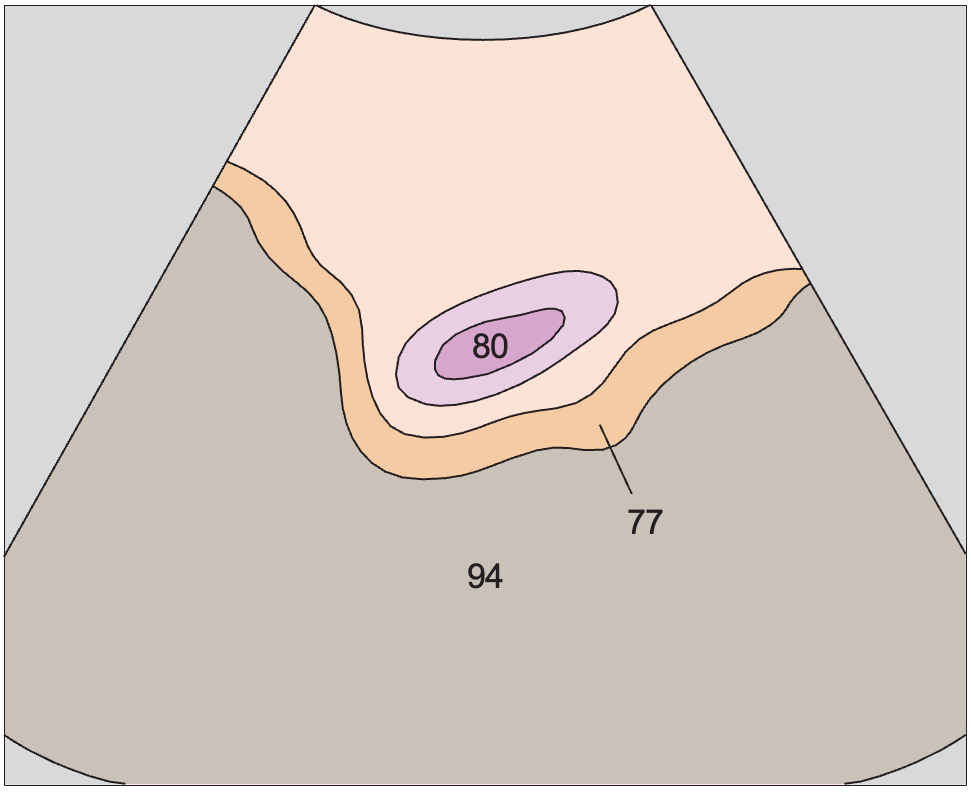 Bladder anatomy diagram, Bladder, bowel