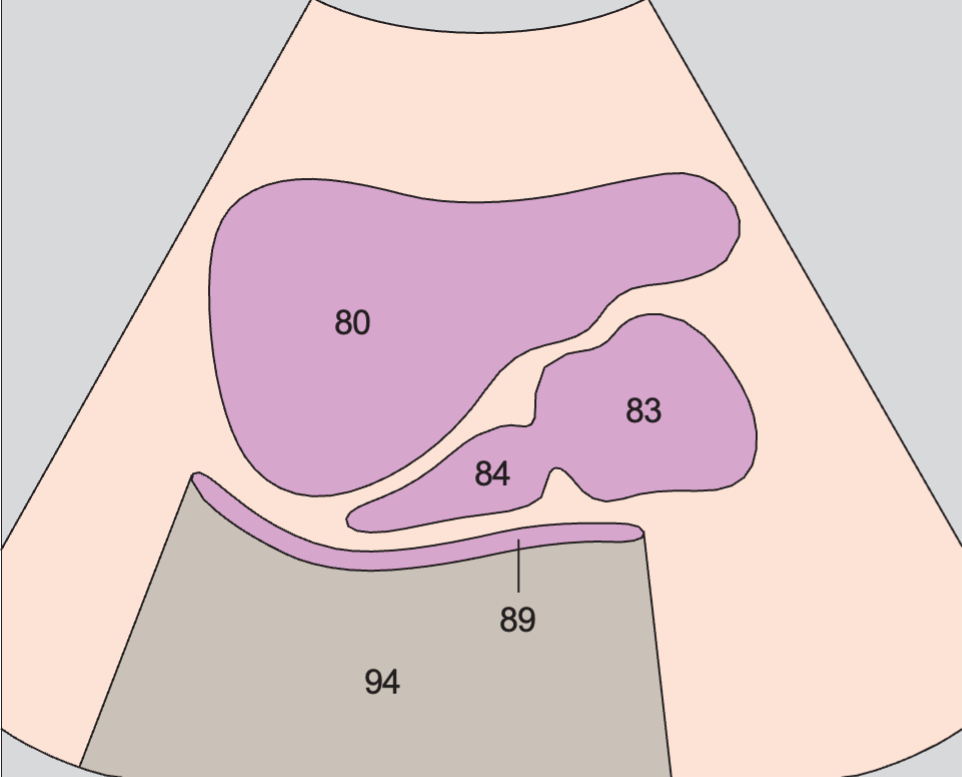 Bladder anatomy diagram, Prostate, rectum, bladder
