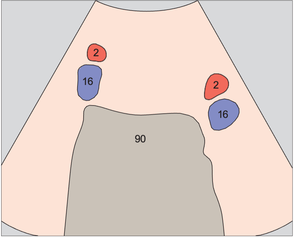 Spinal column anatomy diagram, Iliac vessels