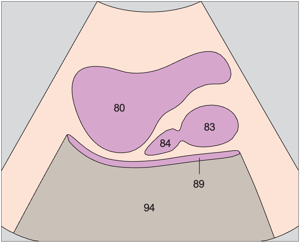 Bladder anatomy diagram, Prostate, rectum, bladder