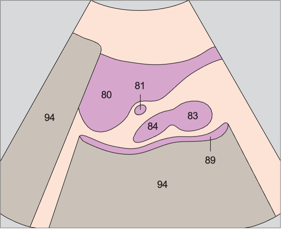 Bladder anatomy diagram, Prostate, seminal vesicles