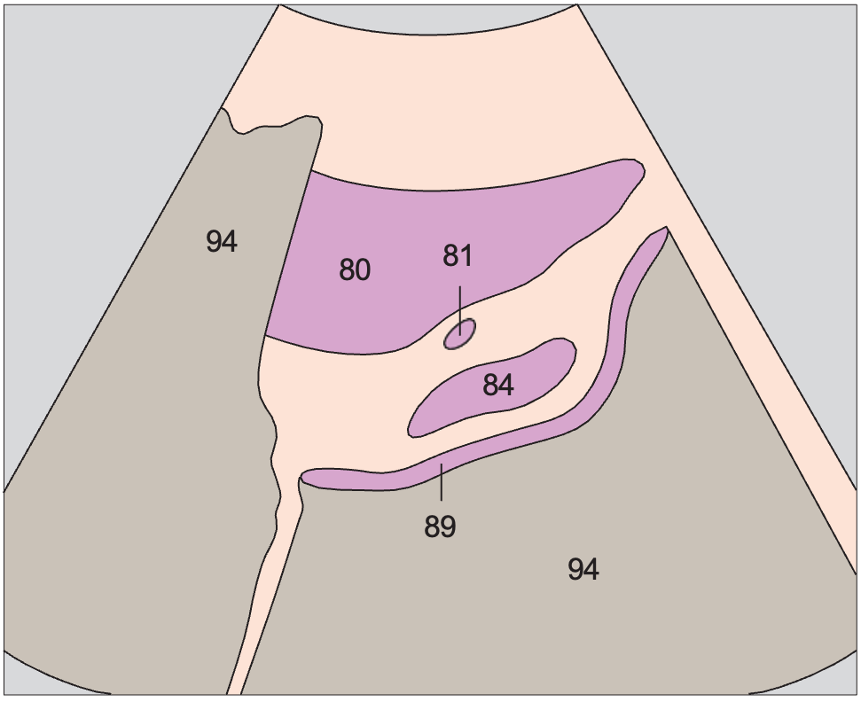 Bladder anatomy diagram, Prostate, seminal vesicles